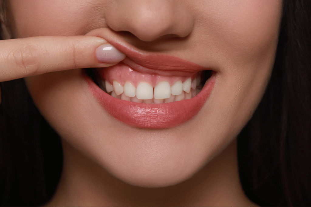 Home Dental Restoration
