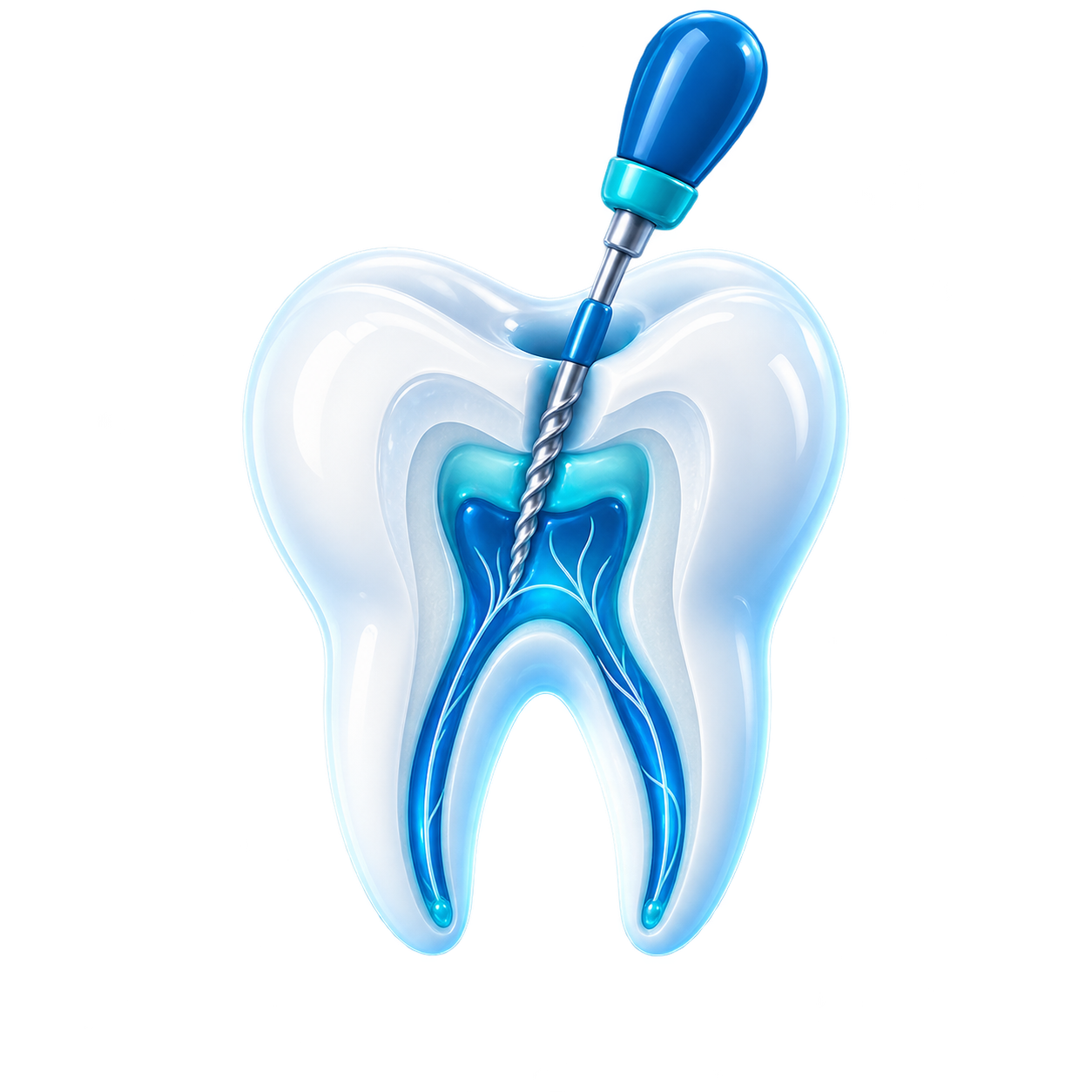 root canal
